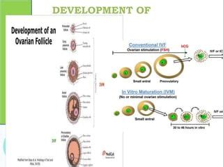 Ivm In Vitro Oocyte Maturation Pptx