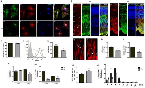 Frontiers A Defective Crosstalk Between Neurons And M Ller Glial