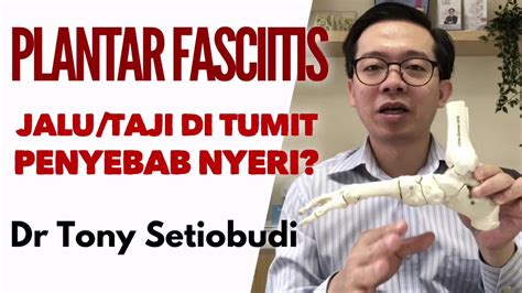 Plantar Fasciitis Jalutaji Di Tumit Penyebab Nyeri Youtube