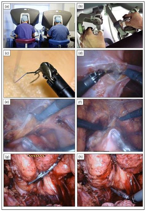 Jcm Free Full Text The Emerging Role Of Robotics In Pelvic