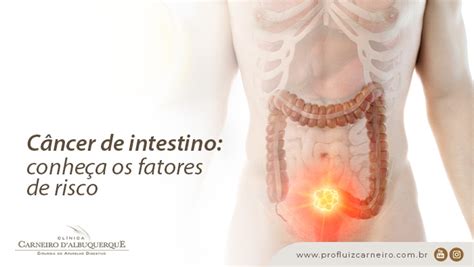 Câncer De Intestino Conheça Os Fatores De Risco Prof Dr Luiz Carneiro