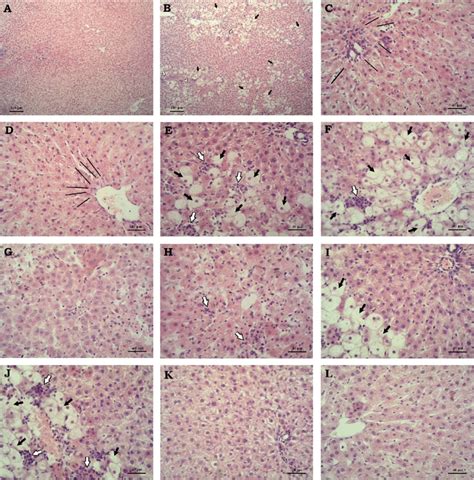 Histopathological Changes In Rat S Livers H E Staining Magnification