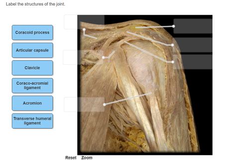 Solved Label The Structures Of The Joint Chegg