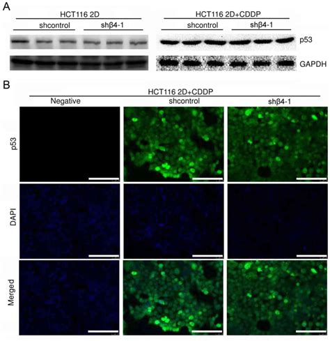 Integrin β4 reduces DNA damageinduced p53 activation in colorectal cancer