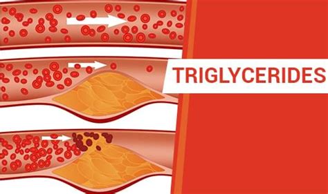 Triglycerides - The Wellness Corner