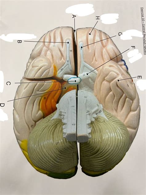 A P Lab Central Nervous System Skin Colored Brain Inferior View