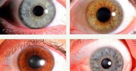 Liberte Sua Mente Iridologia Os Olhos Revelam TambÉm O Estado De Sua