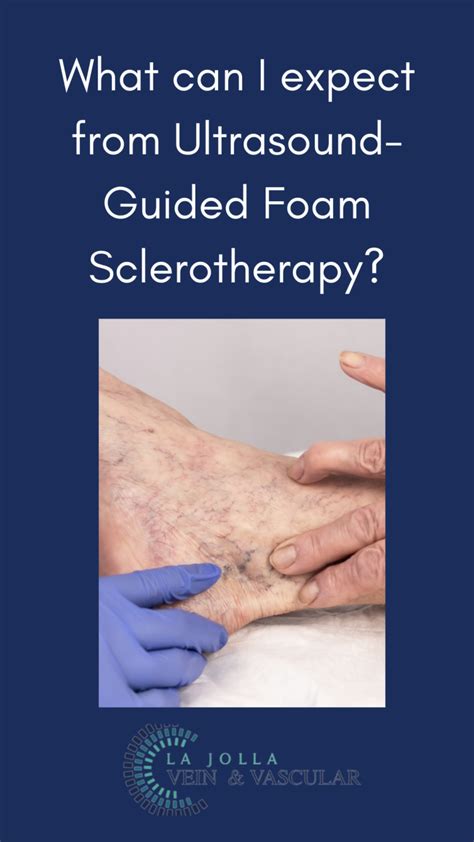 Ultrasound Guided Foam Sclerotherapy Vein And Vascular Care