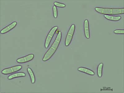 Macroconidia and microconidia of Fusarium falciforme (isolate PPRI20101 ...