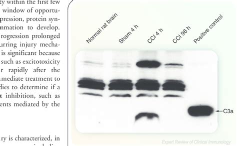 Early Intracerebral Complement Activation After Experimental Traumatic