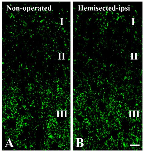 Ijms Free Full Text Synaptic Targets Of Glycinergic Neurons In