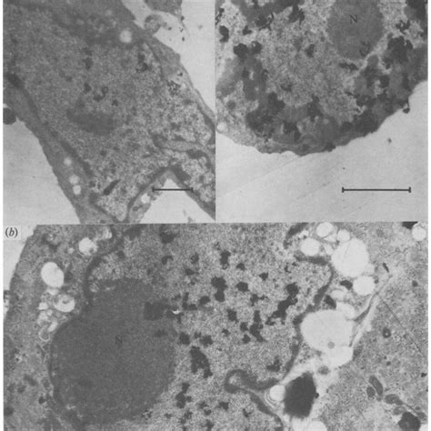 Electron Microscopic Autoradiographs Of Infected Resting Cells A