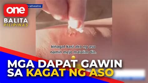 Infectious Disease Expert Nagbigay Paalala Sa Mga Dapat Gawin Kapag