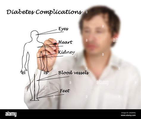 Diabetes Complications Stock Photo Alamy