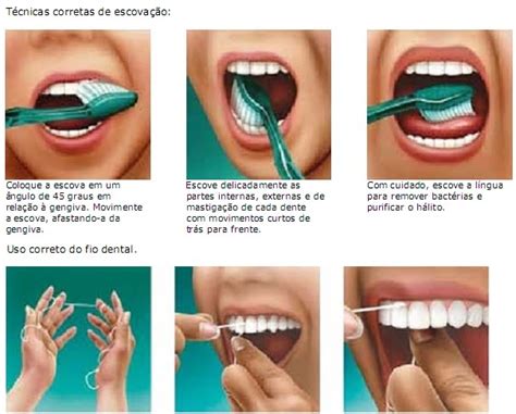 I Técnicas Corretas de Escovação e Uso Correto do Fio Dental