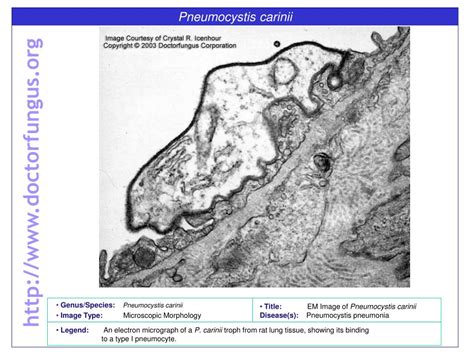 Ppt Pneumocystis Carinii Powerpoint Presentation Free Download Id6693306