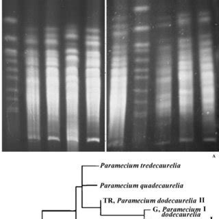 Different Variants Of Pulse Field Gel Electrophoretic Pfge Karyotypes