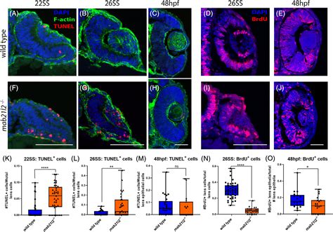 Zebrafish Mab21l2 Mutants Possess Severe Defects In Optic Cup