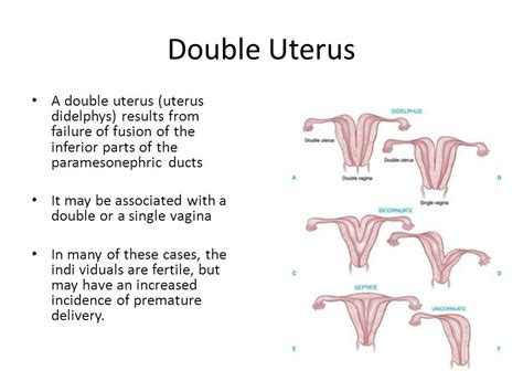 Endometrial Hyperplasia Causes Symptoms And Treatment Options