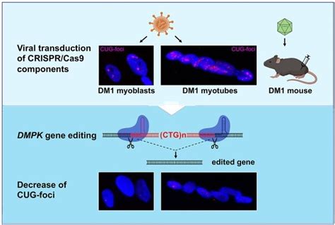 Thérapie génique de la DM1 par CRISPR Cas9 Site des ressources d