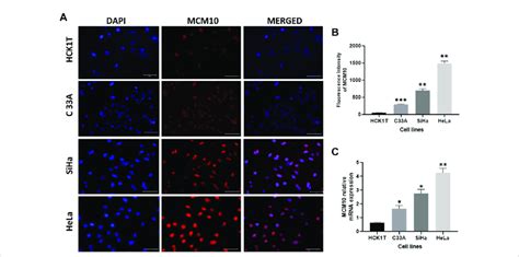 Mcm Expression In Cervical Cell Lines Hck T C A Siha And Hela