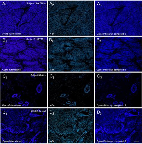 Fluorescence Photomicrographs Of Transmural Sections Of Left