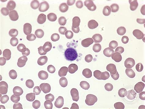 Megakaryocyte Peripheral Blood 1