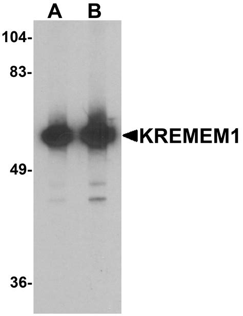 Ihc Plus Kremen Kremen Polyclonal Antibody Rabbit Lsbio