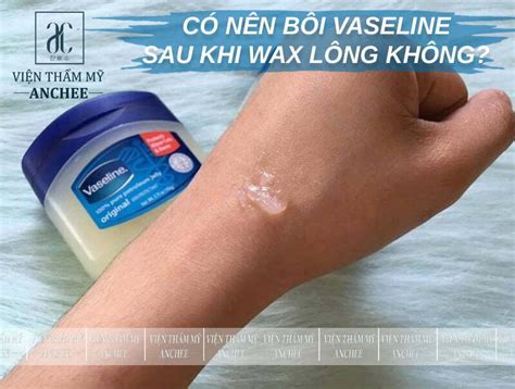 Tư Vấn Về Việc Có Nên Bôi Vaseline Sau Khi Xăm Hình Hay Các Loại Kem Chăm Sóc Da Khác