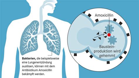 Amoxicillin Wirkung Anwendung Und Nebenwirkungen Apotheken Umschau