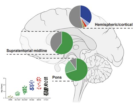 Div Ped Glioma Research Hopp Kindertumorzentrum Heidelberg Kitz