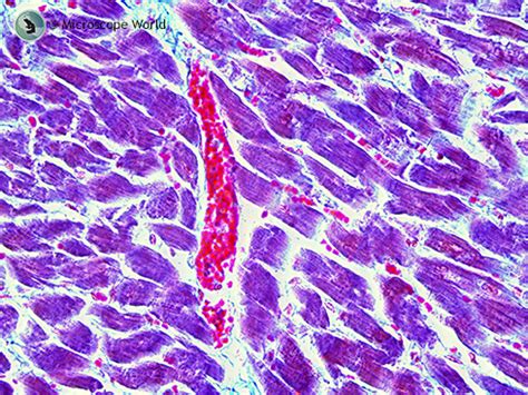 Skeletal Muscle Tissue Under Microscope 400X - Krysfill Myyearin