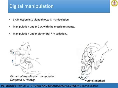 Temporomandibular Joint Dislocation Ppt