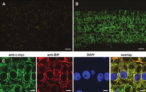 Immunocytological Localization Of The Scfv In Tobacco Mesophyll Cells Download Scientific