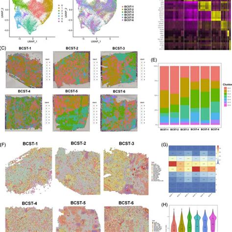 Basic And Deconvolution Analysis Of Visium Spatial Transcriptome Of