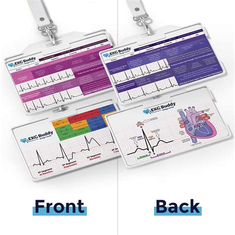 Buy Ekg Buddy Badge Card Set Doubled Sided Nurse Ecg Interpretation