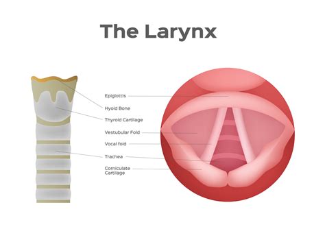 Laryngitis What Is Causes Symptoms Treatment And Prevention