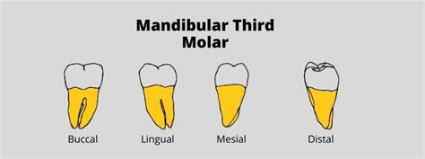 Mandibular Third Molar Morphology Of Tooth Dental Education Hub