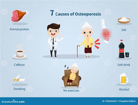 7 Cause Of Osteoporosis Stock Illustration Illustration Of Bone