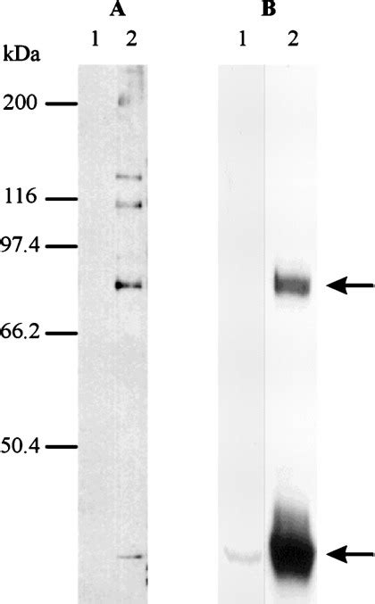 The Transport Of Group 2 Capsular Polysaccharides Across The