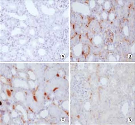 Ring Type Nf Kappa B Nf Kb Decoy Oligodeoxynucleotide Odn Prevents