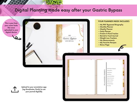 Digital Gastric Bypass Journal, RNY Bypass Hyperlinked Digital
