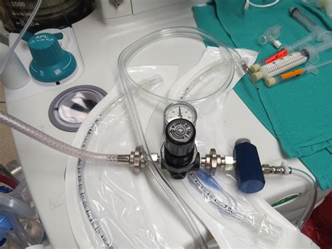 Jet Ventilation Anesthesia Transoral For Laryngeal Surgery Iowa