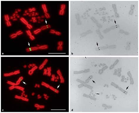 Chromosomal Localization Of The 18s 28s Rrna Genes And Nucleolar