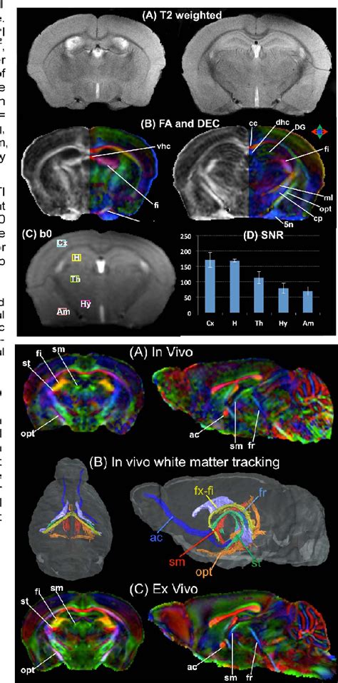 Figure From In Vivo High Resolution Diffusion Tensor Imaging Of The