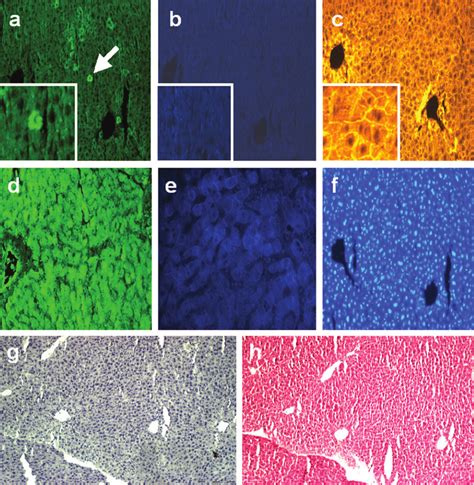 Immunostaining Of Serial Sections Reveals That Hepatocyte Like Cells