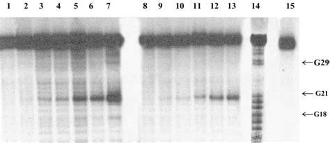 Autoradiogram Of Denaturing Polyacrylamide Gel Showing A Time