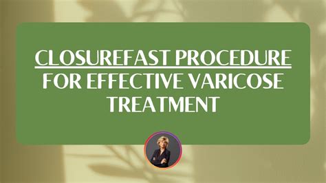 Varicose Vein Treatment With Closurefast Procedure Youtube