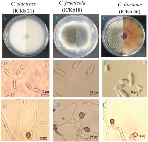 Morphological Characteristics Of Present Isolates Belonging To