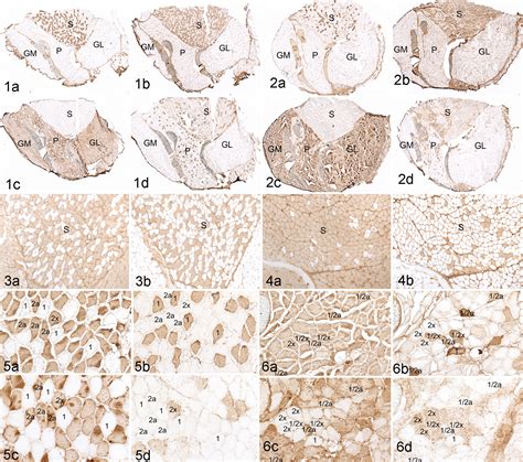 Gastrocnemius Muscle Mouse